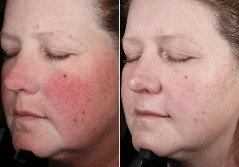 (plated) Skin Science INTENSE Serum