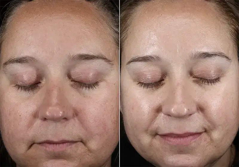 (plated) Skin Science INTENSE Serum