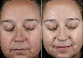 (plated) Skin Science INTENSE Serum