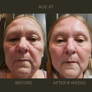 Purana Skincare Eternal Youth Advanced Rejuvenation Concentrate