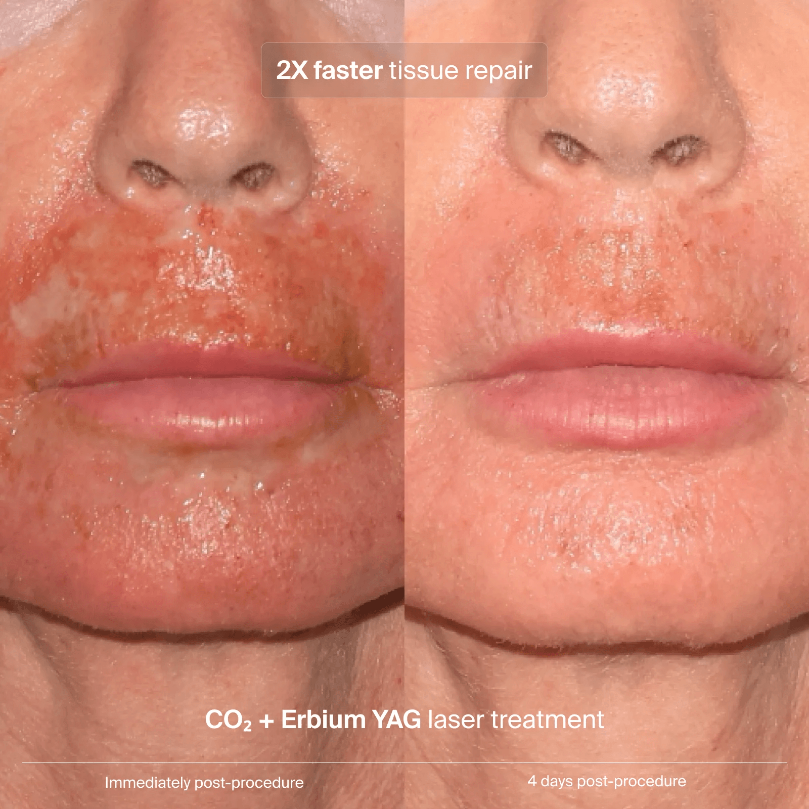 Pavise Extracellular Matrix Restore