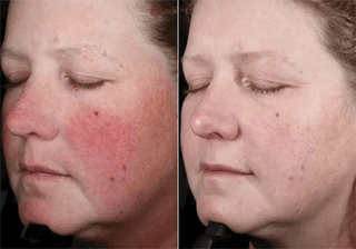 (plated) Skin Science INTENSE Serum