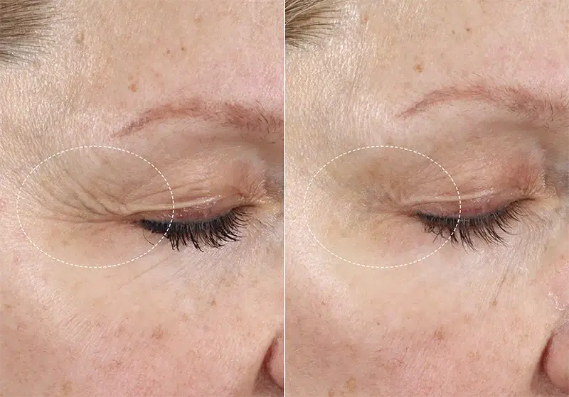 (plated) Skin Science INTENSE Serum