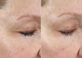 (plated) Skin Science INTENSE Serum